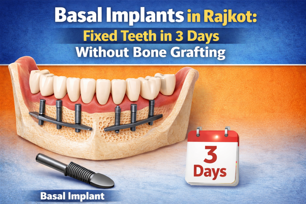 Basal implants in Rajkot overview